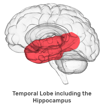 Temporal Lobe (includes the Hippocampus)